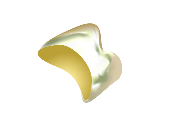 金歯