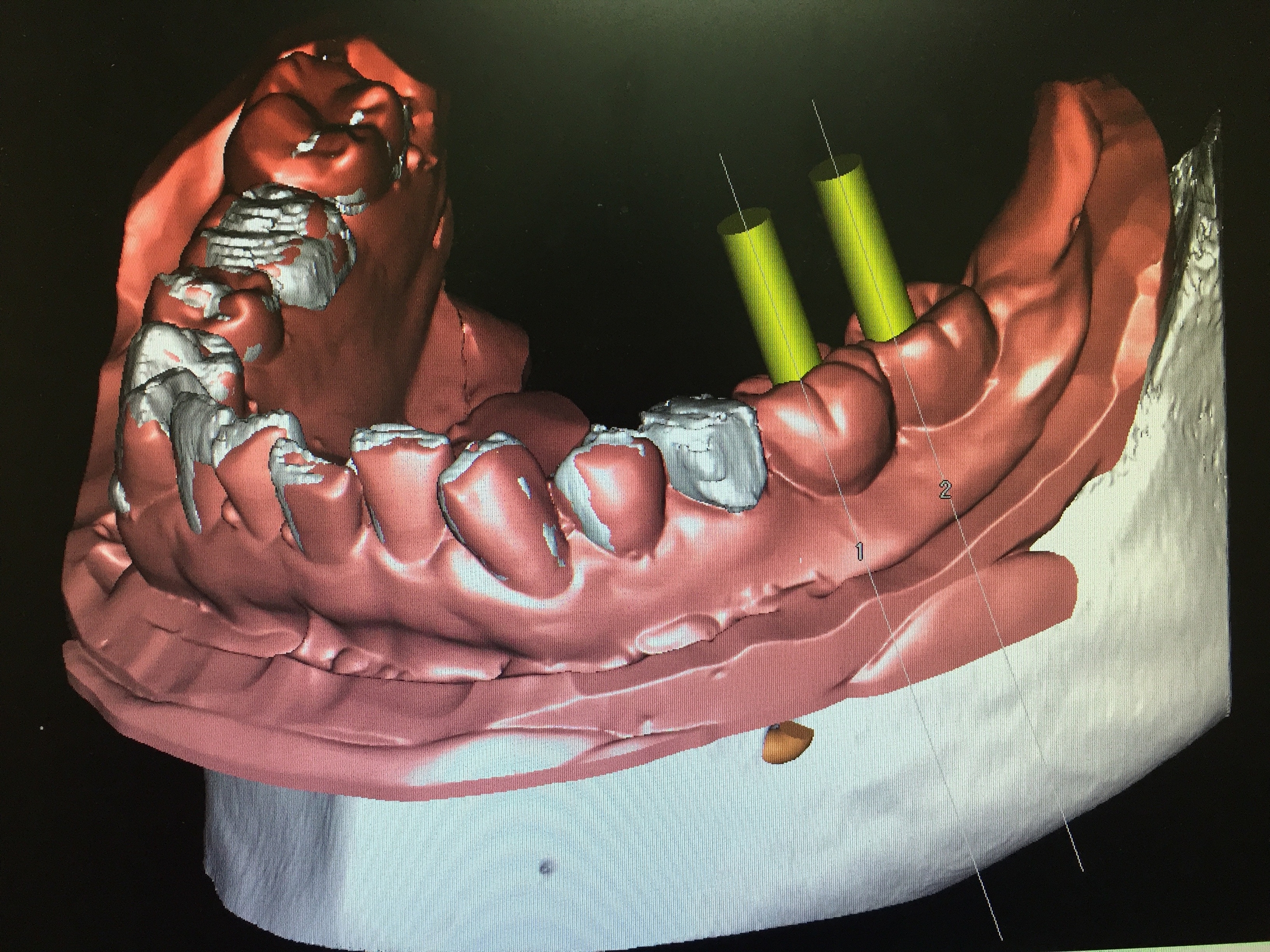 CADCAM